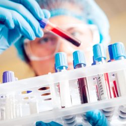 A scientist with googles looks at different vials of blood.