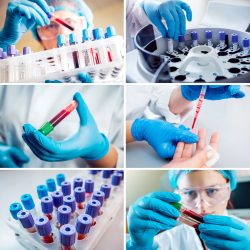 A composite image of close-up photos of blood samples.