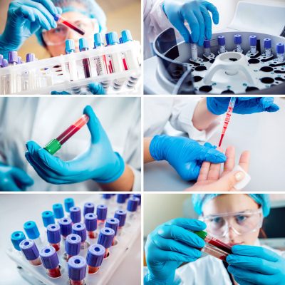 A composite image of close-up photos of blood samples.